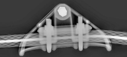 X Ray Inspection Services Header
